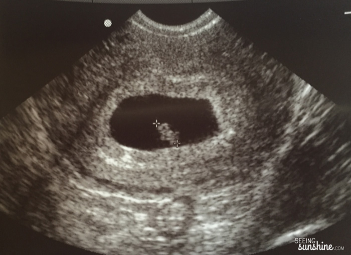 Our First Ultrasound